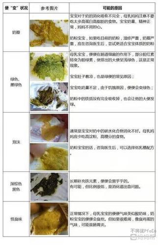 第三代代孕宝宝拉泡沫便什么原因